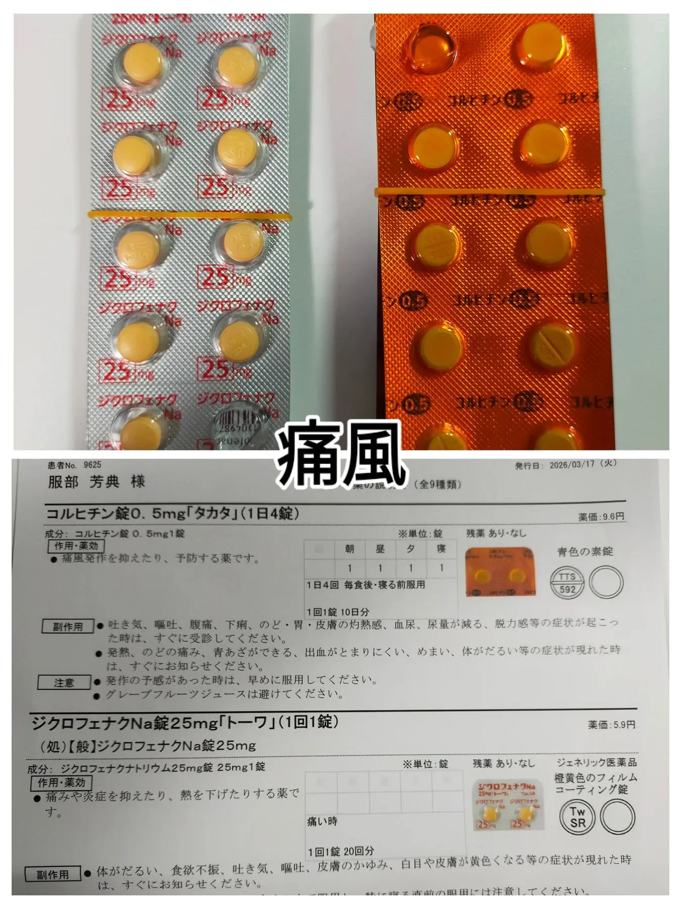 痛風発作で大苦戦中です…💦